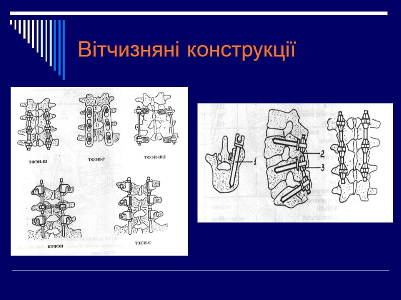 Вітчизняні конструкції